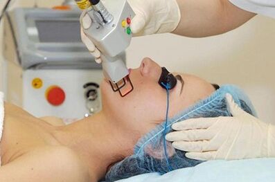 Types of laser facial skin rejuvenation