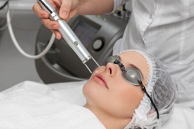 Benefits of laser rejuvenation